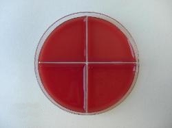 Sheep blood agar